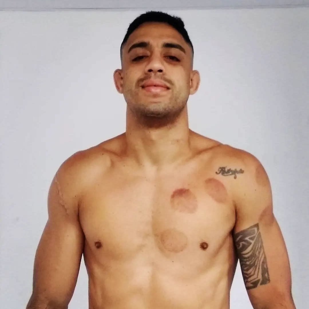 Patrick Gomes